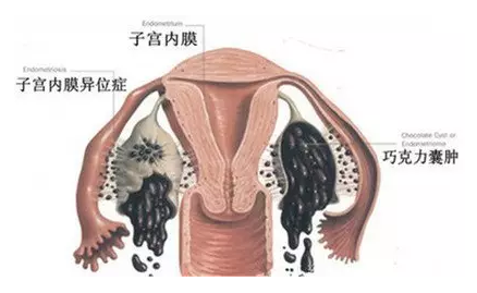 重庆送子鸟医院