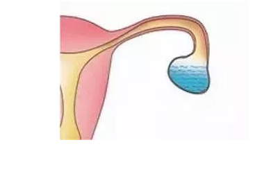 重庆送子鸟医院