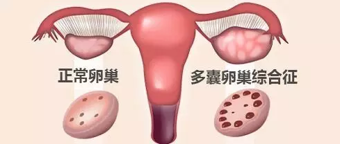 重庆送子鸟医院