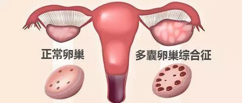 重庆送子鸟医院