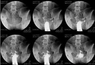 重庆送子鸟医院