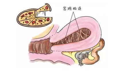 重庆送子鸟医院