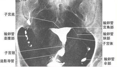 重庆送子鸟医院
