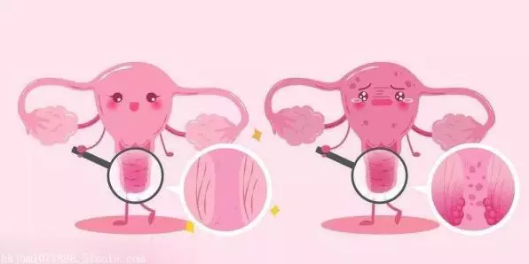 重庆送子鸟医院,粘连