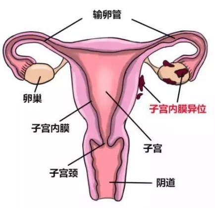 重庆送子鸟医院